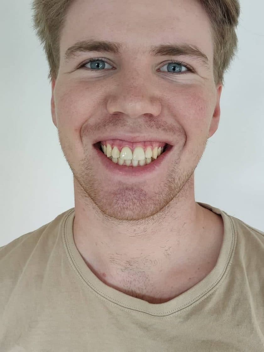 Nicolai Hvid